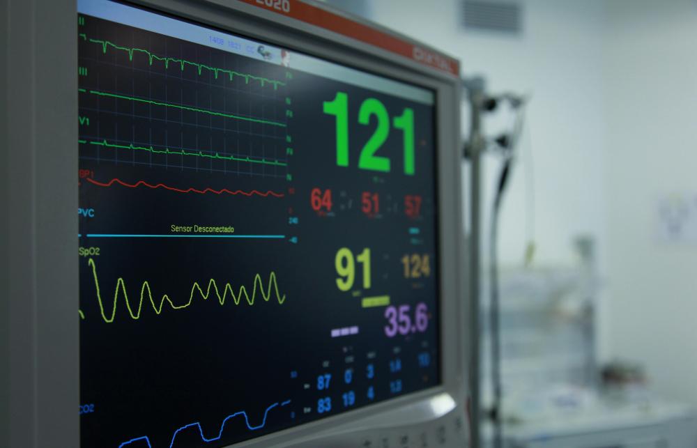 A bedside monitor in ICU